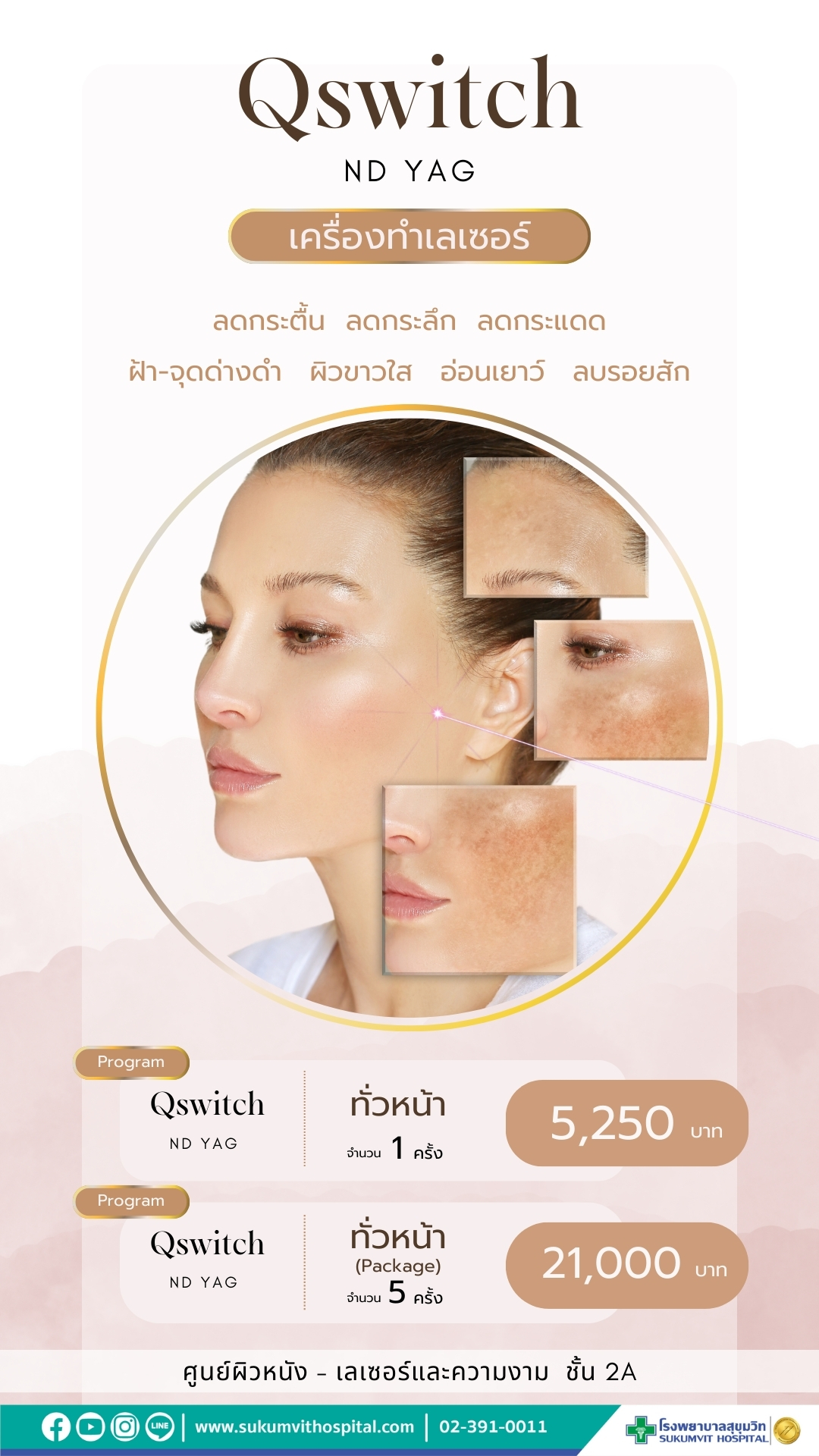เลเซอร์, รักษาผิว, หน้าใส