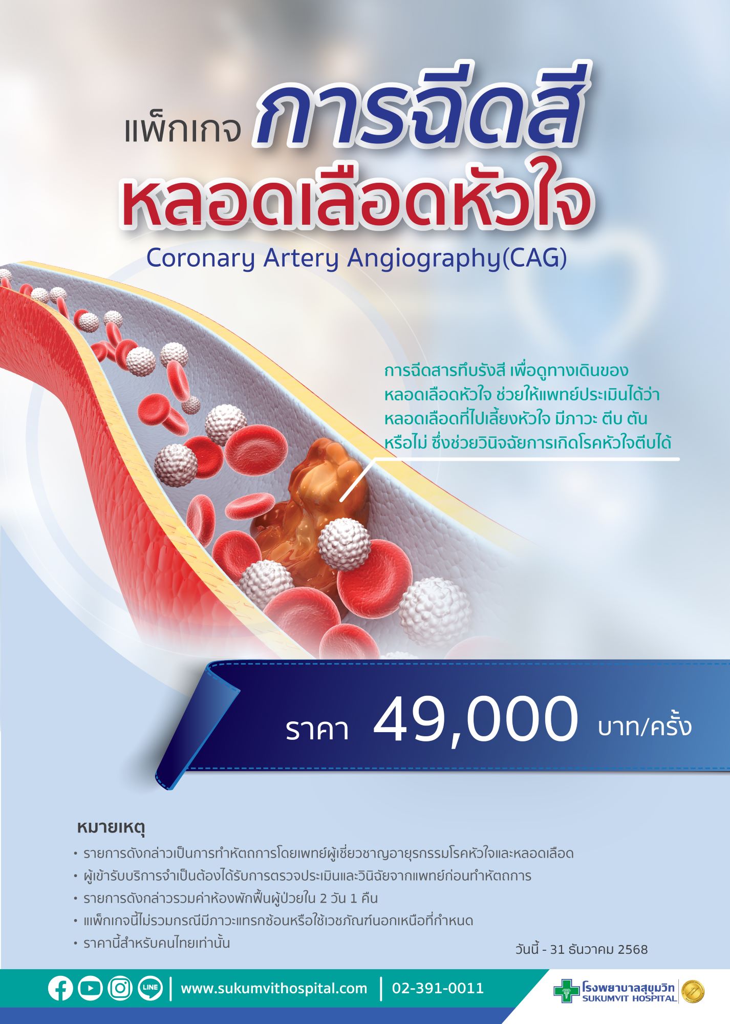 ฉีดสีสวนหัวใจ